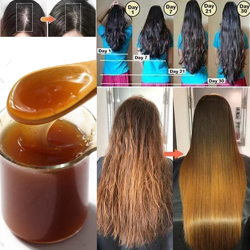 

Ginner Shampoo Hair Growth Serum Anti Preventing Hair Loss Alopecia Liquid Damaged Hair Repair Growing