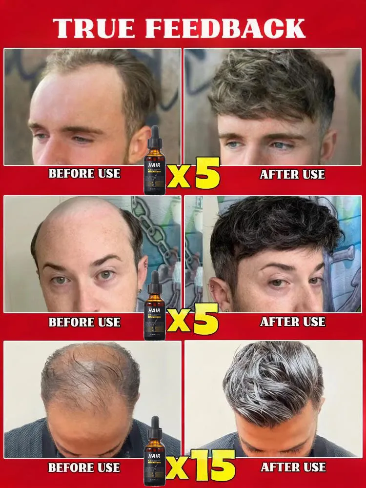 ปลุกเส้นผมที่ยังไม่ได้เติบโตให้เกิดการเติบโตอย่างมากมาย