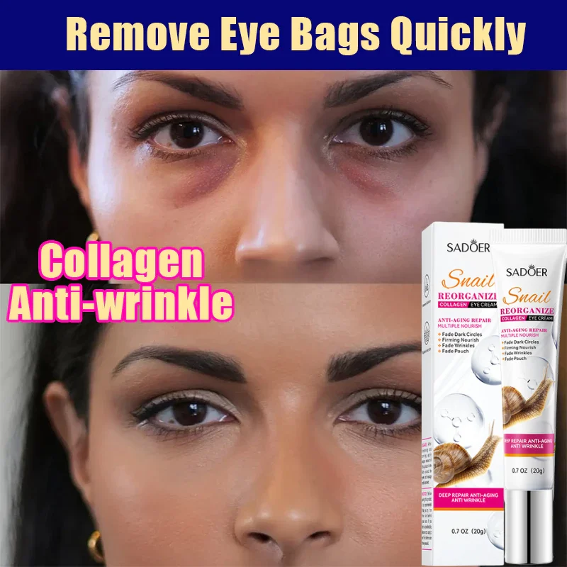 

Remove Eyes Bags Eye CreamSnail Collagen Anti Dark Circles Anti-wrinkleMoisturizing Firming Beauty Eyes SkinCare Products
