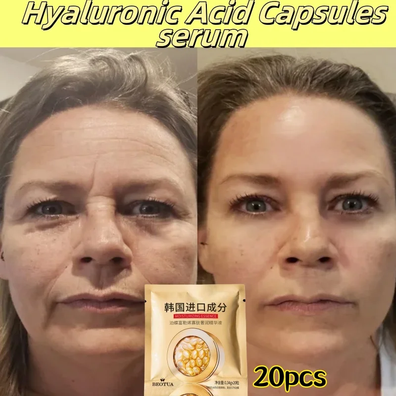 

Hyaluronic Acid Capsules Serum Remove Face Fine Line Anti-wrinkle Ageless Firm Repair Spot Whiten Skin Care Cosmetics