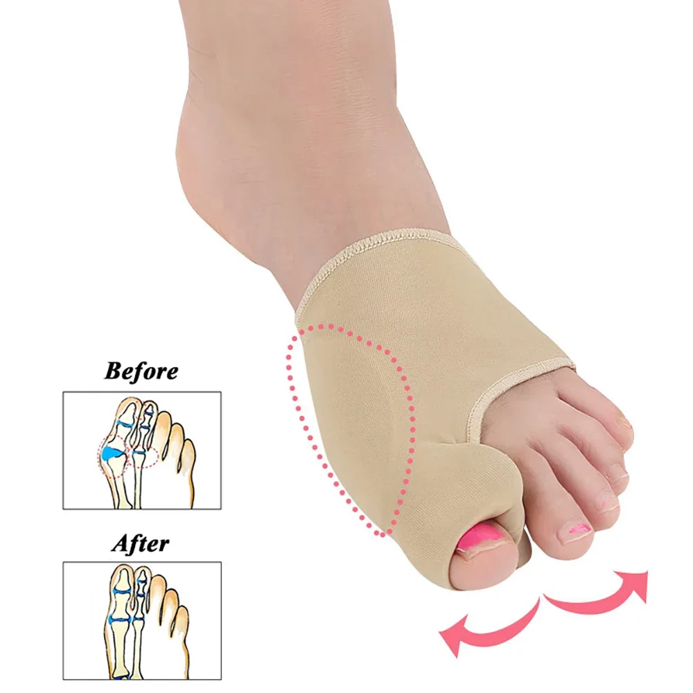 2 Stück große Zehenschienen zur Korrektur von Hallux Valgus, Fußpflege-Socken für Fußgelenkschutz und Fußpflege.