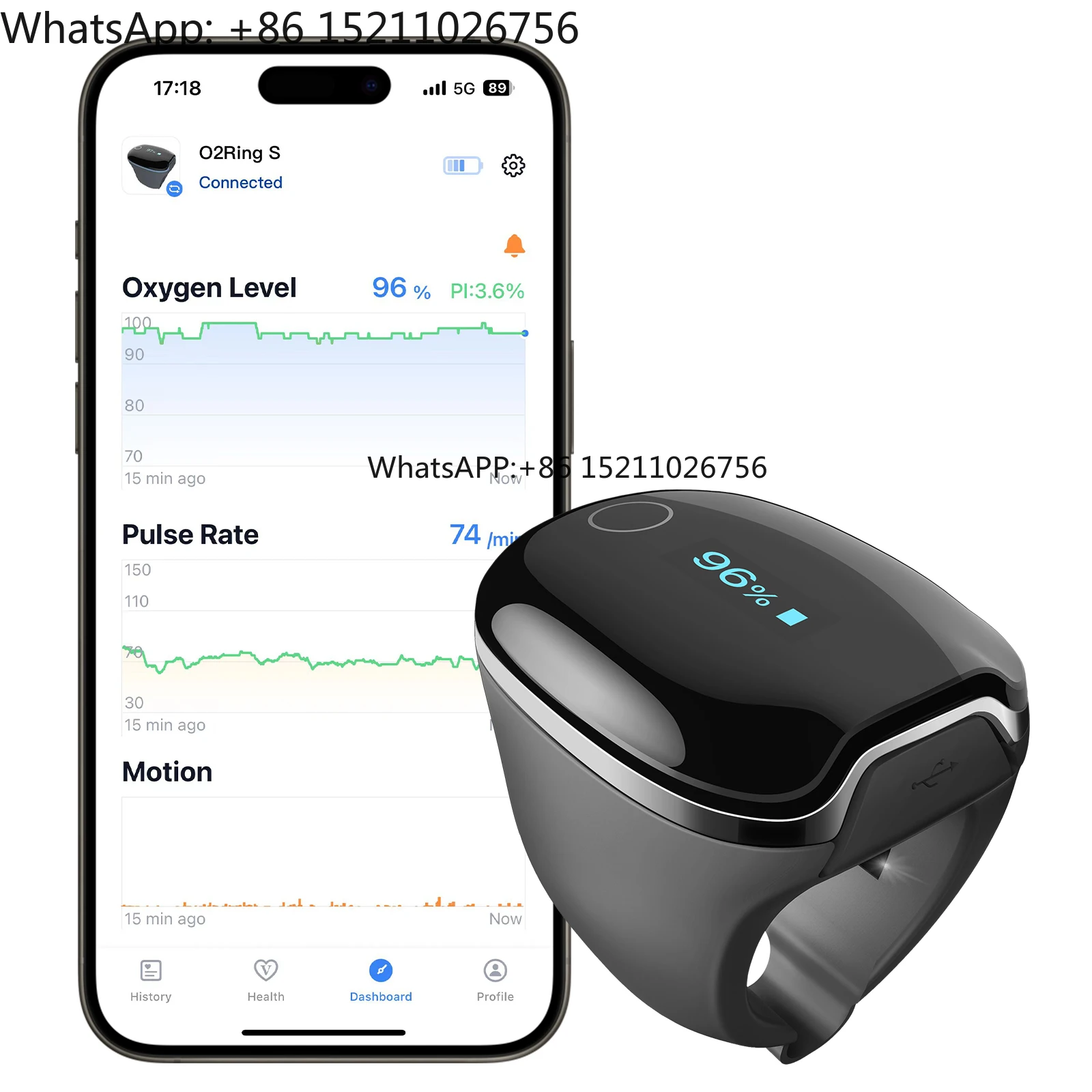 Умное кольцо Wellue O2ringS Bluetooth для отслеживания сна и здоровья - цифровой пульсоксиметр с датчиком SpO2