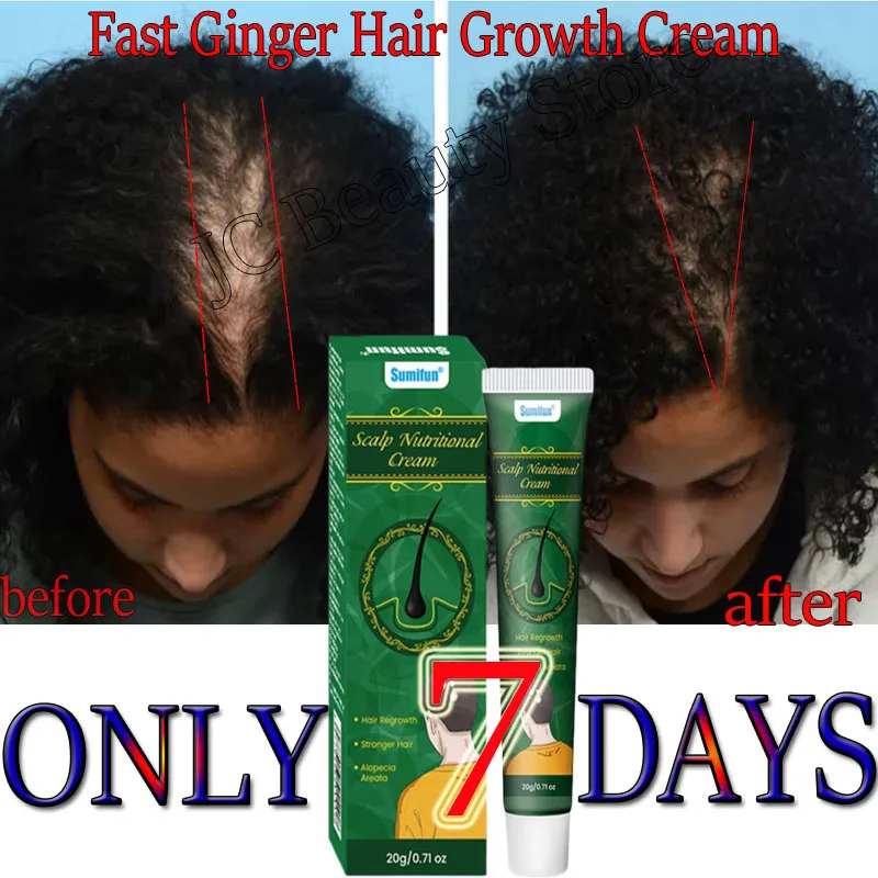 

Крем против роста волос, быстрый имбирный крем от выпадения волос, восстановление облысения, лечение поврежденной кожи головы, питательные средства для ухода за корнями волос для женщин и мужчин