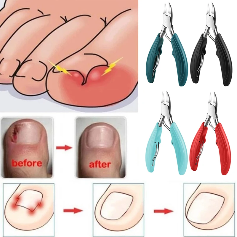 Profissional toe cortador de unhas ferramenta de unhas encravadas unhas grossas removedor de sujeira de pele morta super afiado lâmina curvada ferramentas de unhas