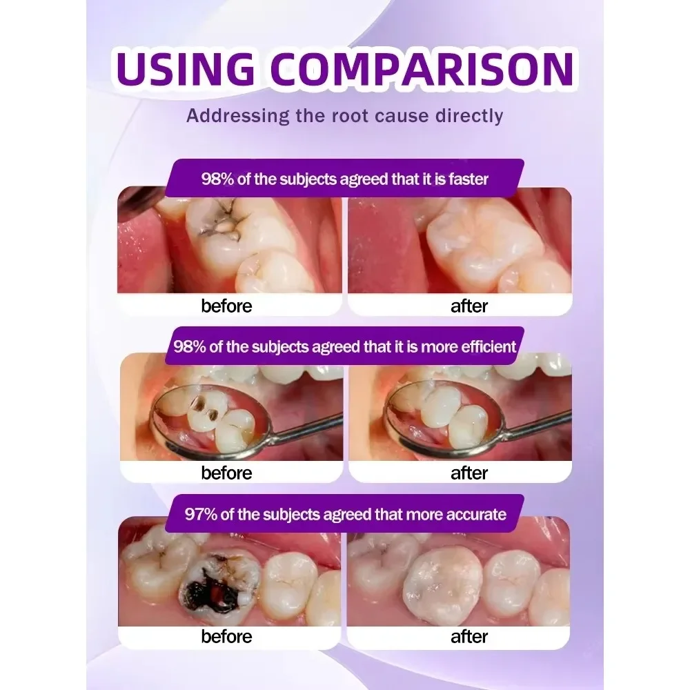 معجون أسنان جديد لمنع تسوس الأسنان علاج فعال لتبييض الأسنان معجون أسنان أصفر إزالة معجون الأسنان العناية بالأسنان #3