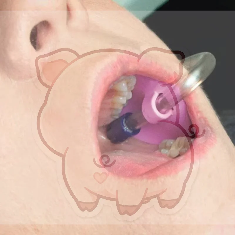 Dental Saliva Ejector Suction Tubes 10 Pcs Leak-proof Soft Tongue Guard for Oral Surgery Post Operative Care
