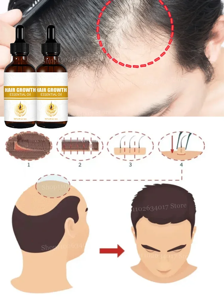 Discover the Secret to Abundant Hair Growth