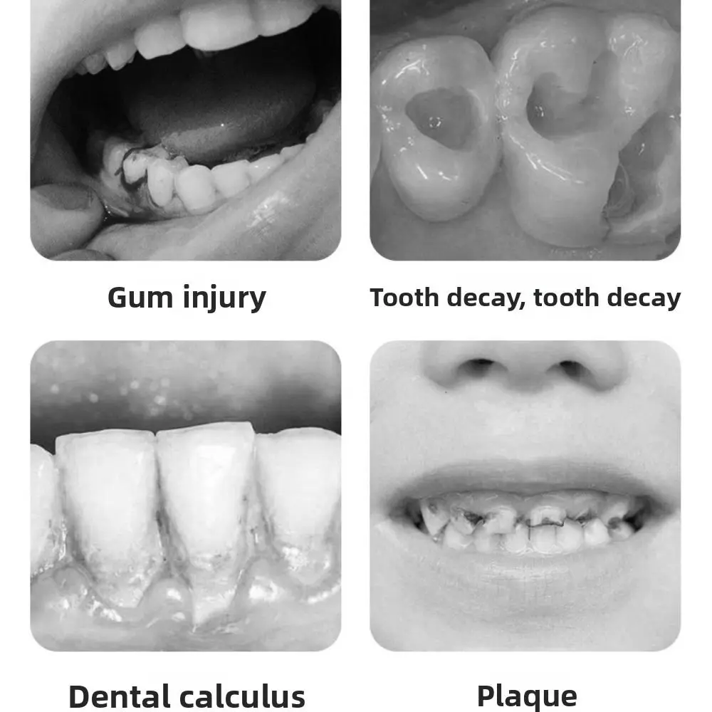 USB قابلة للشحن عن طريق الفم الري نبض التكنولوجيا طوي هيكل جهاز تنظيف الأسنان بالماء 4 فوهات الذكية الكهربائية الفم غسالة