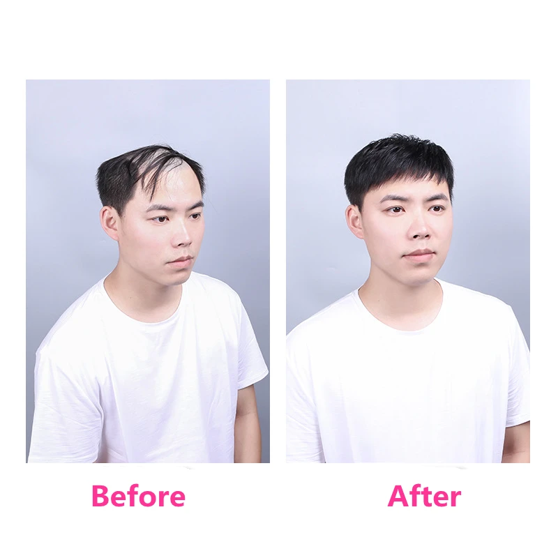 Short Real Human Hair Toupee with 4 Clips for Men's Baldness Prosthetic Wig Male Hair Replacement System Piece