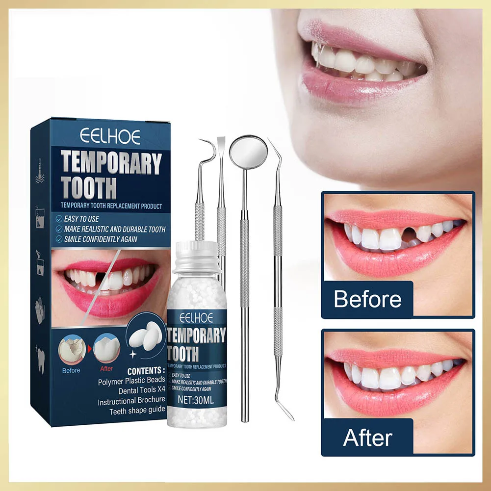 30ml Dental Restoration Kit Temporary Solid Tooth Filler Particles Practical Unisex Adults with 4 Dental Tools Tooth Beauty Tool