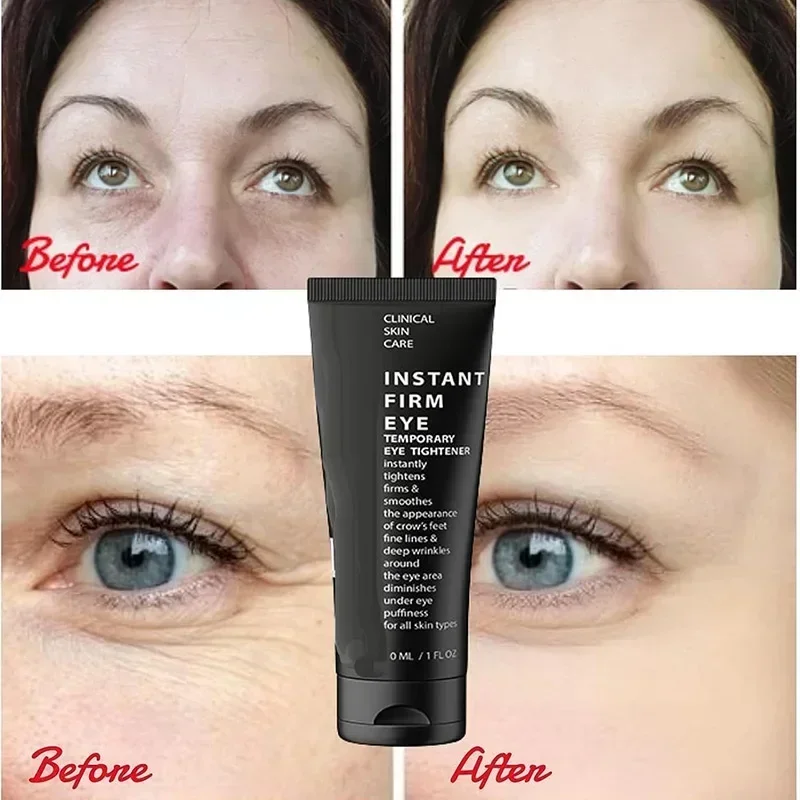 1/2/3pc Instant Firm Eye Tightener Eye Bag Tightener Eye Bag Tightener Eye Tightener To Diminish Bag Under Eyes Dark Circles