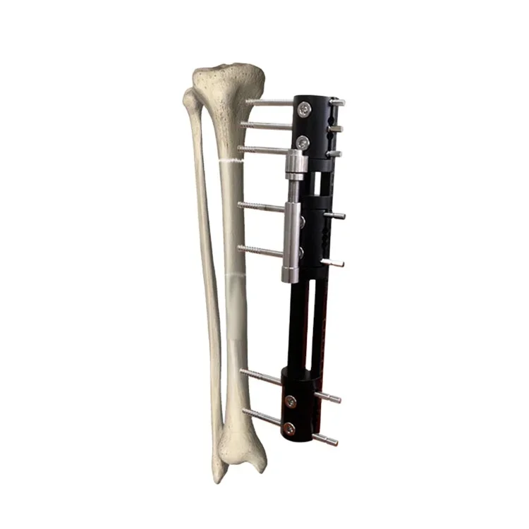 

Orthopedic Tibial Multi-Function External Fixation Surgical Instruments