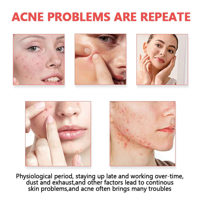  الوجه العناية بالبشرة حب الشباب بثرة التصحيح غير مرئية المهنية شفاء امتصاص بقعة ملصق تغطي للرجال والنساء #2