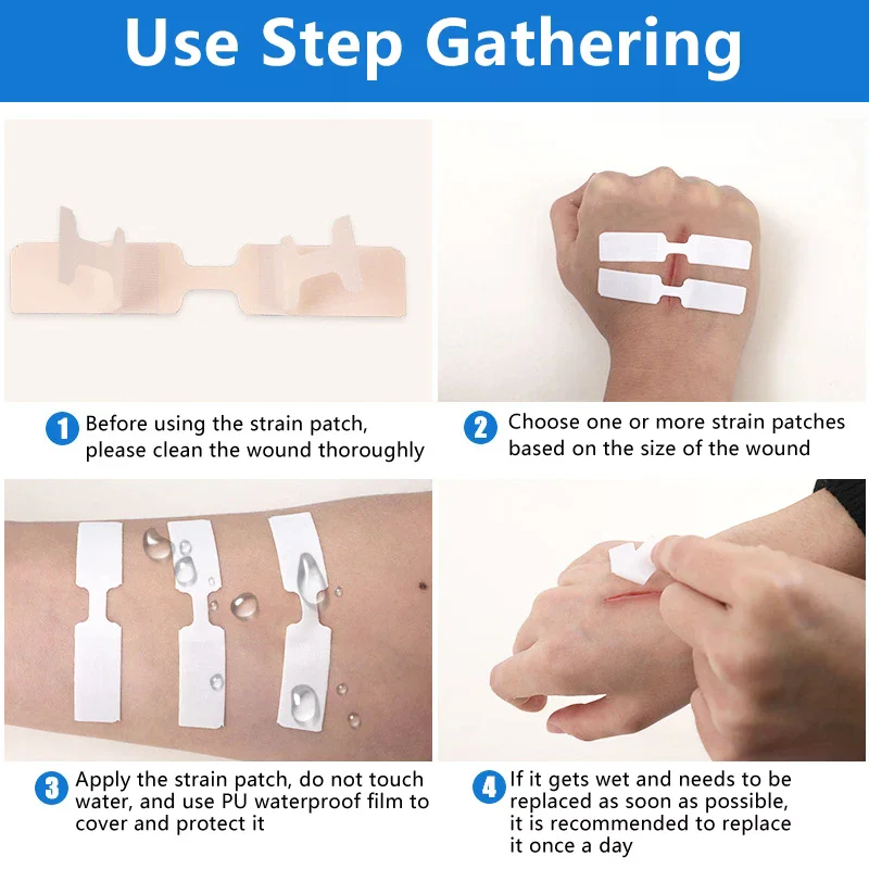 Бандажные полоски с застежкой-бабочкой, клейкая строчка для ран, антипригарная подушечка для кожи, 1/3/10/50, пластыри - медицинская повязка для резей и ломтиков