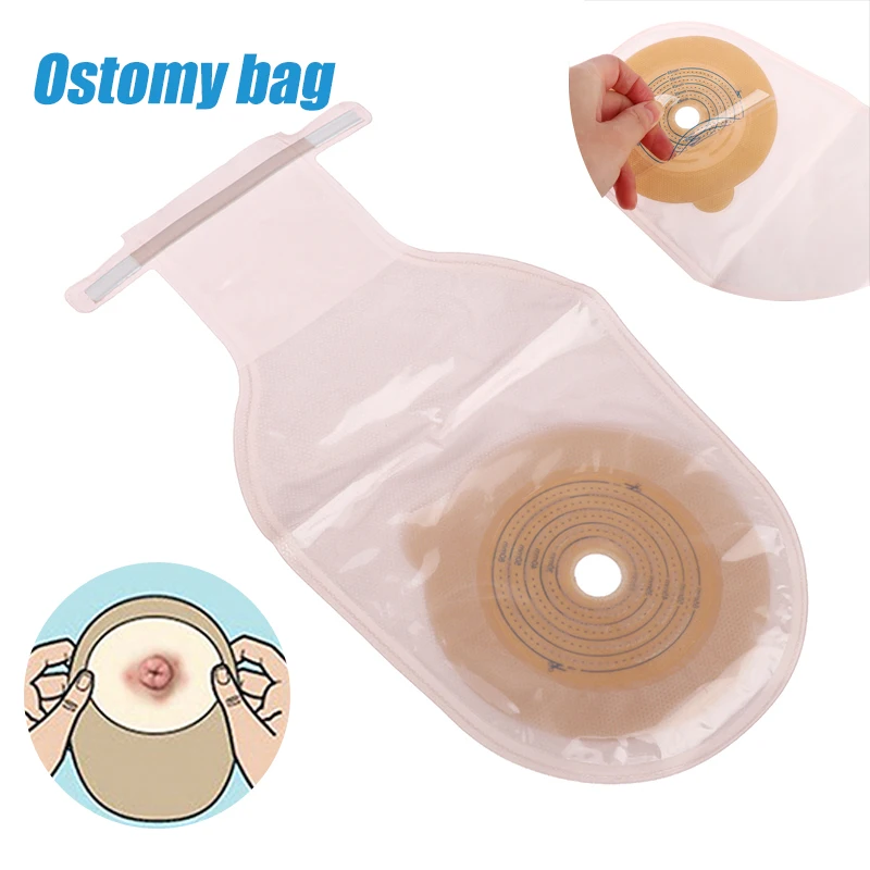 Colostomy Bags Max Stoma 60mm Skin Color Ostomy Bags with Hook & Loop Back Window Drainable Ostomy Pouch 10 Pcs