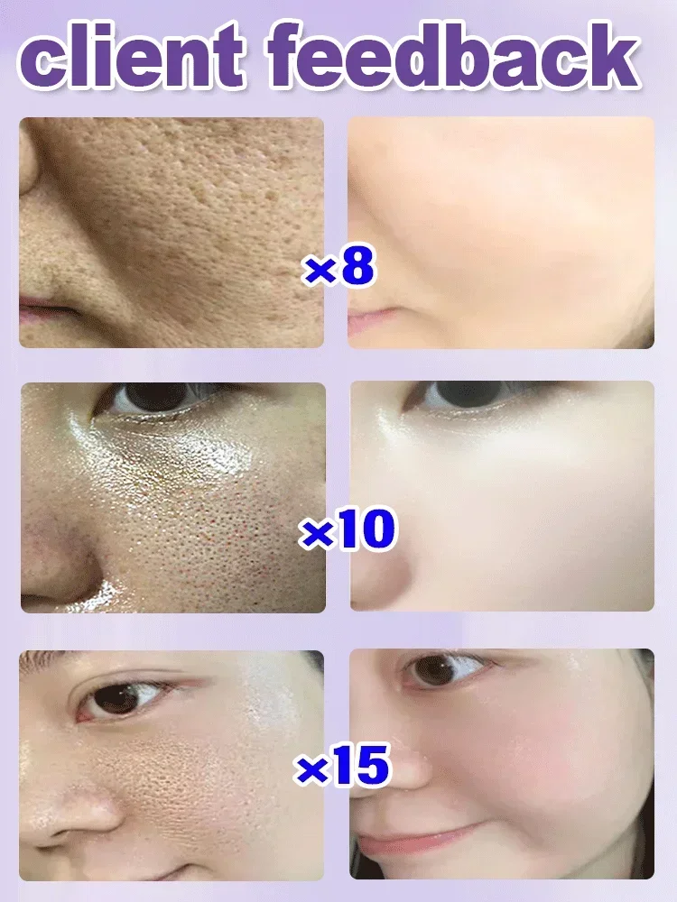 Effective Pore Shrinking Serum Pores Blackheads Whitening Moisturizing Smooth Skin Care Product Relieving Drynes Control Firming