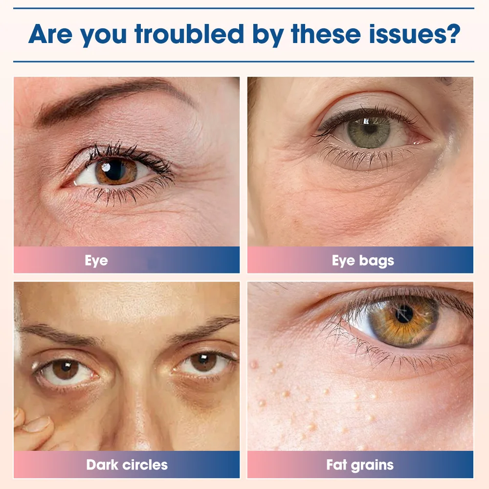 Masażer LED do oczu z czerwonym światłem, ujędrniający i napinający skórę, redukujący cienie pod oczami, urządzenie kosmetyczne.