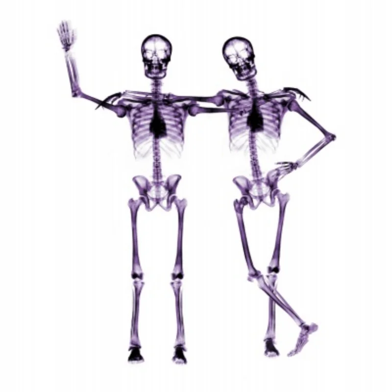 Metalowa obudowa tylnej osi do WLtoys 12428 12423 12427 12428-A 12428-B 12428-C FeiYue 1/12 RC Części do samochodów