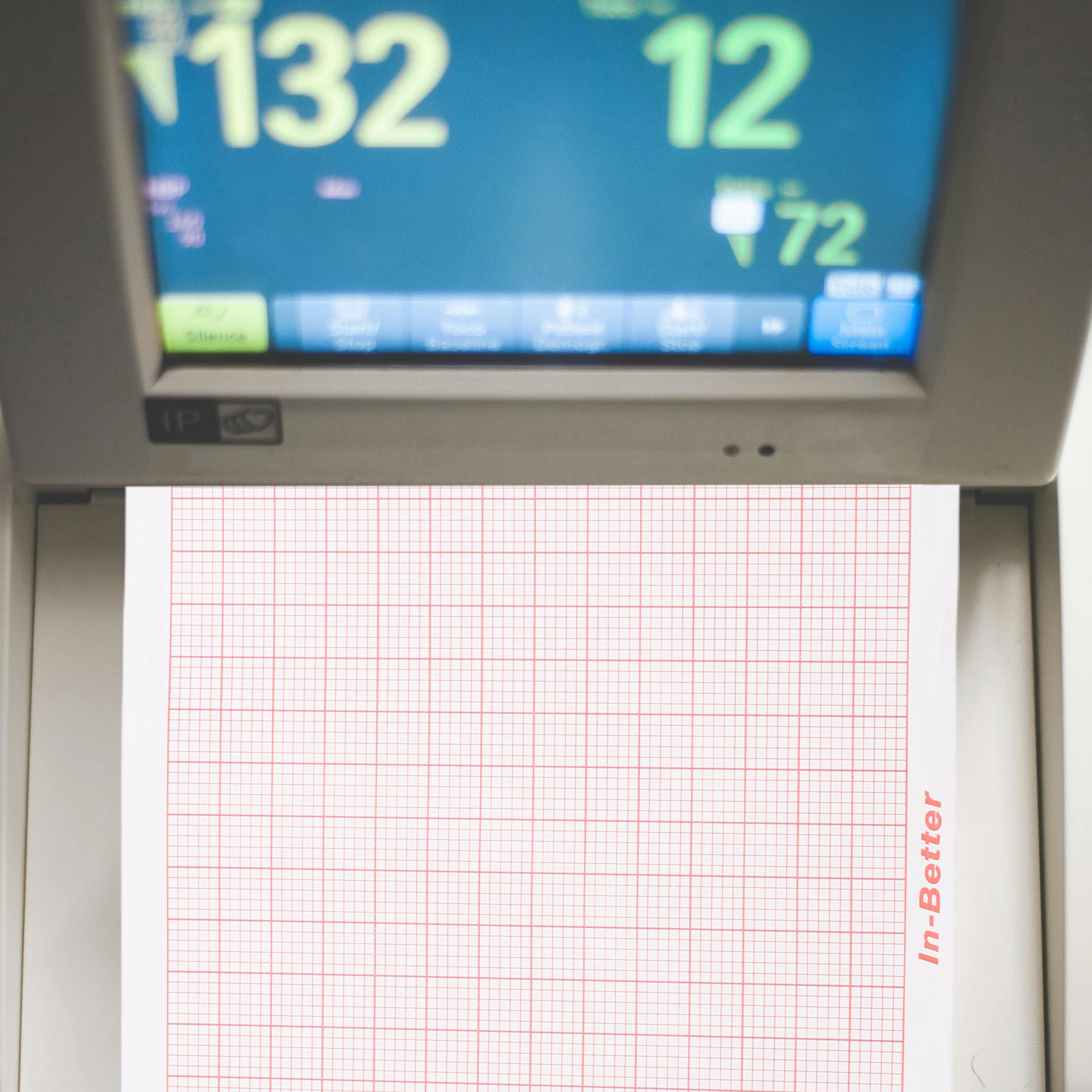 Electrocardiogram Paper Chart Replacement for -3 300 Machines Clear Print Quality Blank Refills Medical Monitoring System