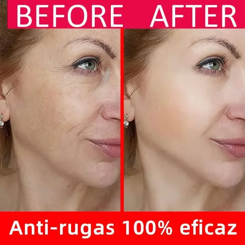 Gesichts feuchtigkeit creme Anti-Aging-Serum Anti-Falten-Gesichts serum entfernen Falten feine Linien um die Augen Krähen Füße Hals falten