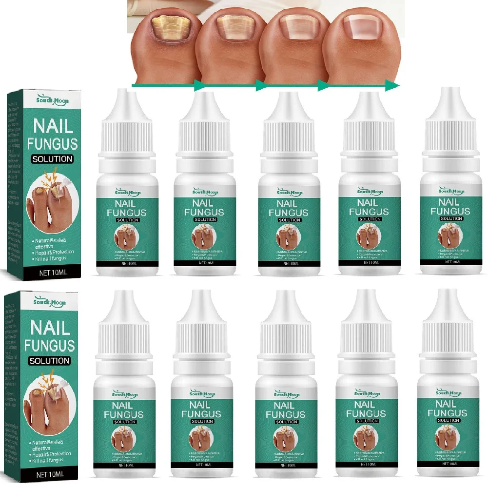 

10 шт., сверхсильная сыворотка для лечения грибка ногтей, эссенция для ухода за ногтями, восстанавливающая эссенция, гель для инфекции пальцев ног, сыворотка для удаления грибка ногтей