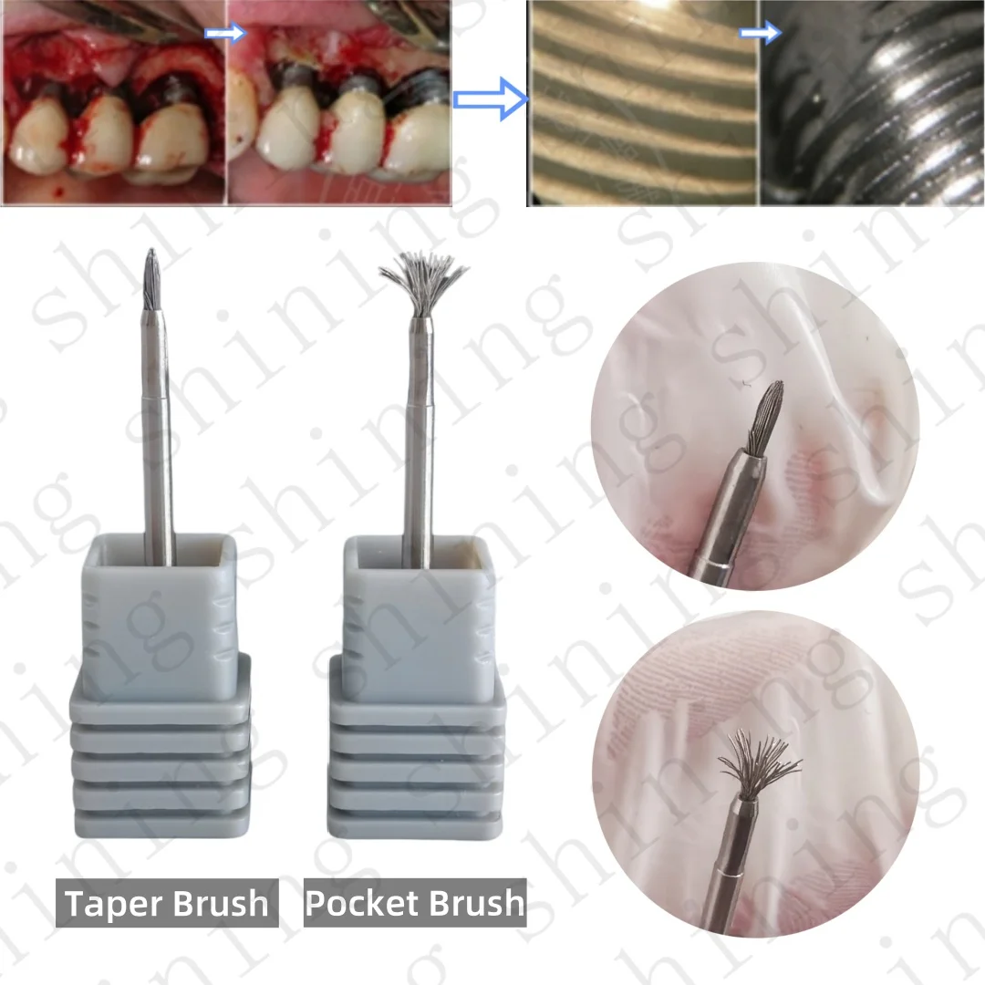 Dental Implant Surface Cleaning Brush Peri-Implantitis Threads Tool Instrument Abutment Cleaning brush Fixture Cleaning Brush