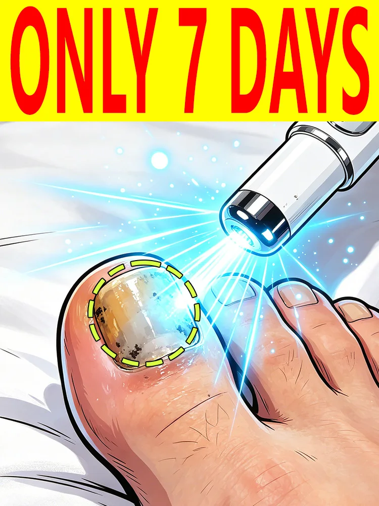 Technology optimized laser pen with essence creates long-lasting anti-recurrence effects for daily onychomycosis care