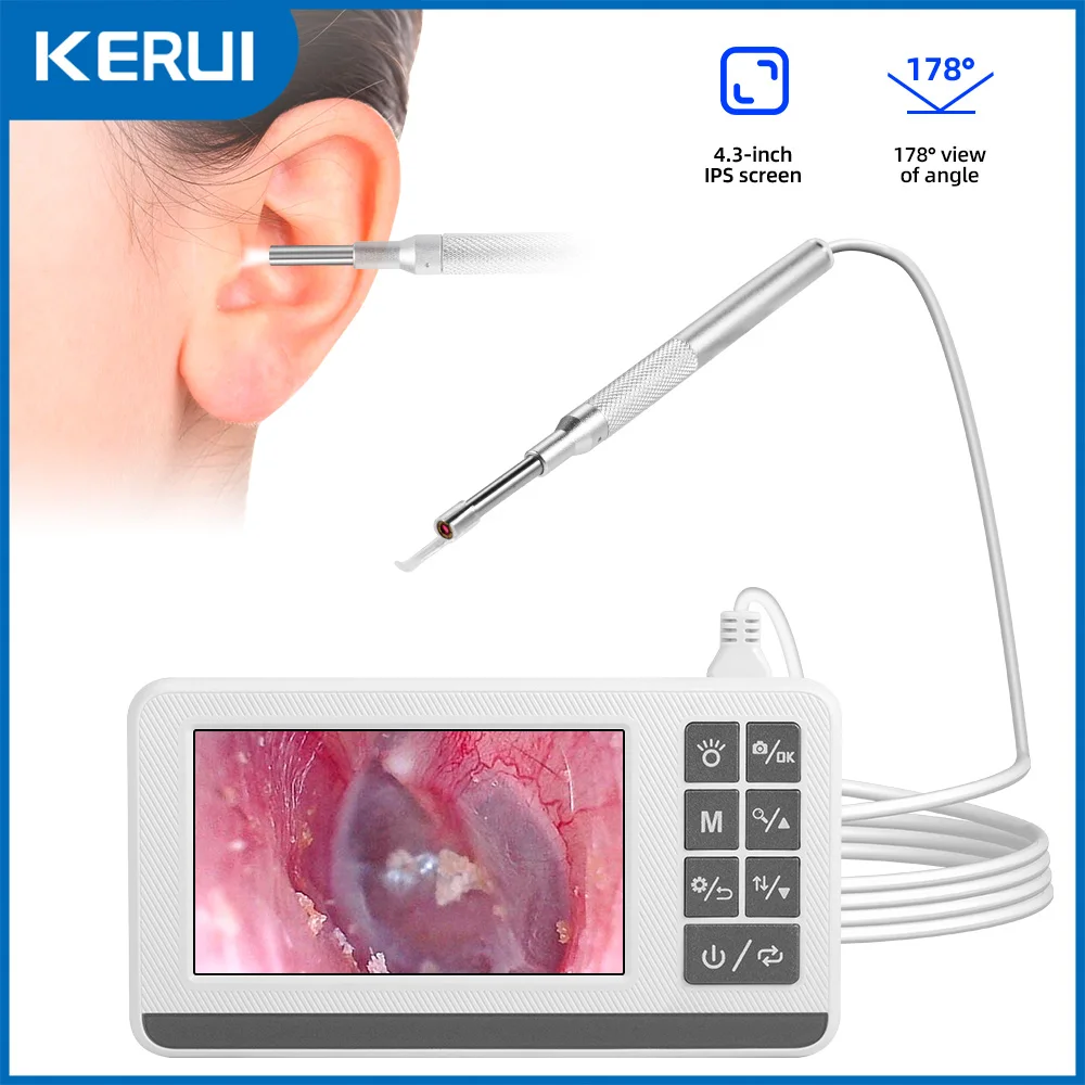 KERUI Otoscope 3.9mm Ear Endoscope Camera with 6 Lights 4.3 Inch Screen Ear Wax Removal Tool Earpicker for Kids Adults P60