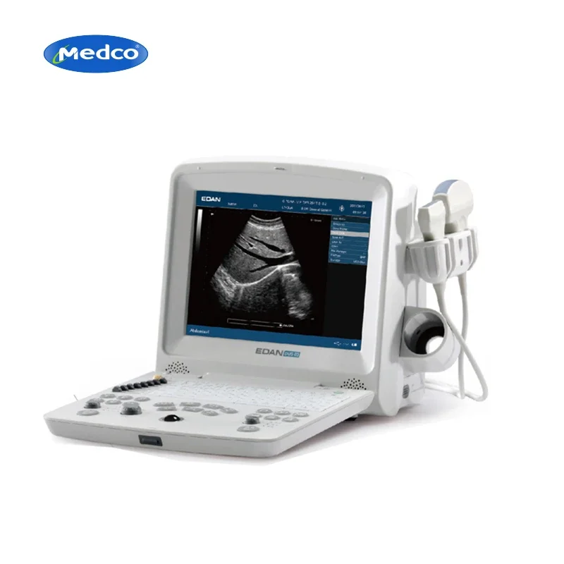 portable Edan ultrasound machine black and white ultrasound machines