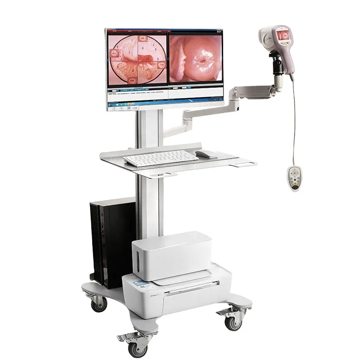 Digital Electronic Video KN-2200I HD Video Vaginal Camera For Gynecology