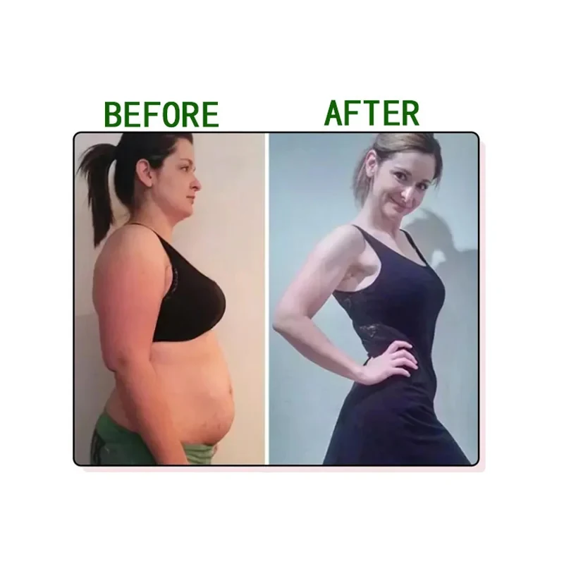 Slimming Products for Men and Women, Garcinia Cambogia Extract , Fat Burning and Cellulite, Detox Anti Nature Health Care