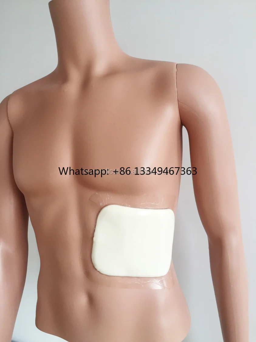 

Aluminium Chest Rib Splint Instrument Fixer for supplier