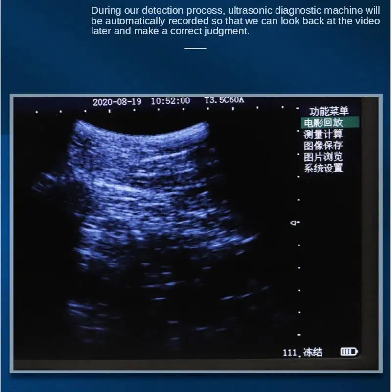 Portable Veterinary Ultrasound Scanner 5.6 Inch LCD Screen Pregnancy Testing Machine for Cattle Cow Pig Horse