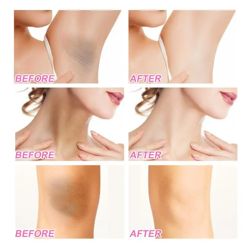 Niacinamide Body Whitening Cream For Underarm Bleaching Armpit Lightening Intimate Area Moisturizer Korean Skin Care Product