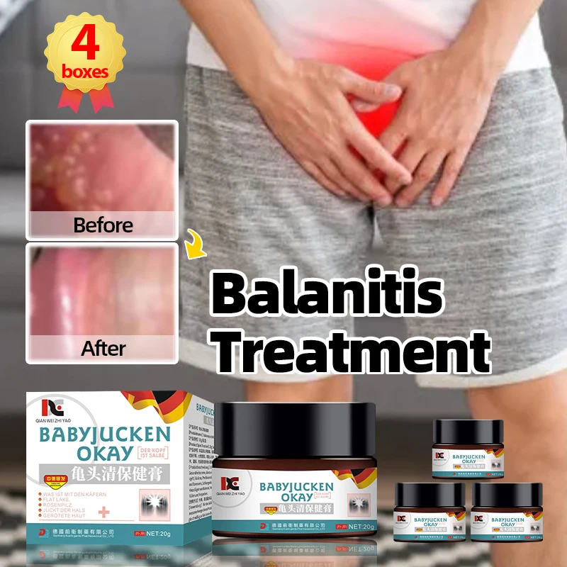 

Germany Balanitis Treatment Cream Glans Foreskin Fungal Ointment Anti Infection Papules Pearl Rash Red White Dot Itch Medicine