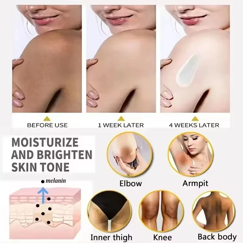 Crema blanqueadora para partes privadas, suero blanqueador para axilas, blanqueador a tope, rodilla, ilumina la parte interior del muslo, partes íntimas, elimina la melanina