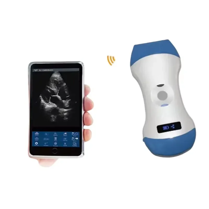 Wireless Electric Portable Handheld Scanner 3-in-1 Linear Convex Probes CE Certified Class II Medical
