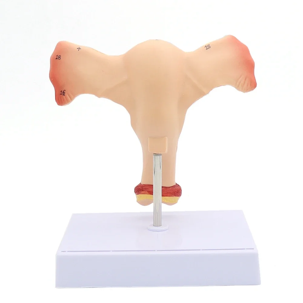 Female Uterus Ovary Model Female Genital Anatomy Model Medical Teaching Model