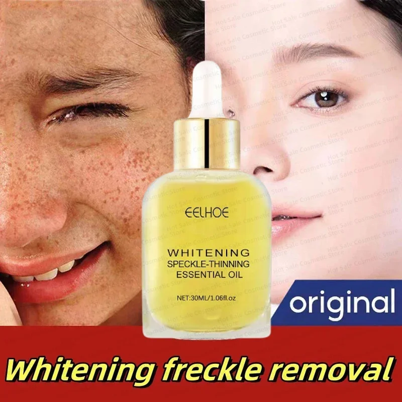 

Whitening Freckles Vitamin C Serum Remove Dark Spots Freckles Fade Melanin Nicotinamide Essence Brighten Moisturizing Skin Care