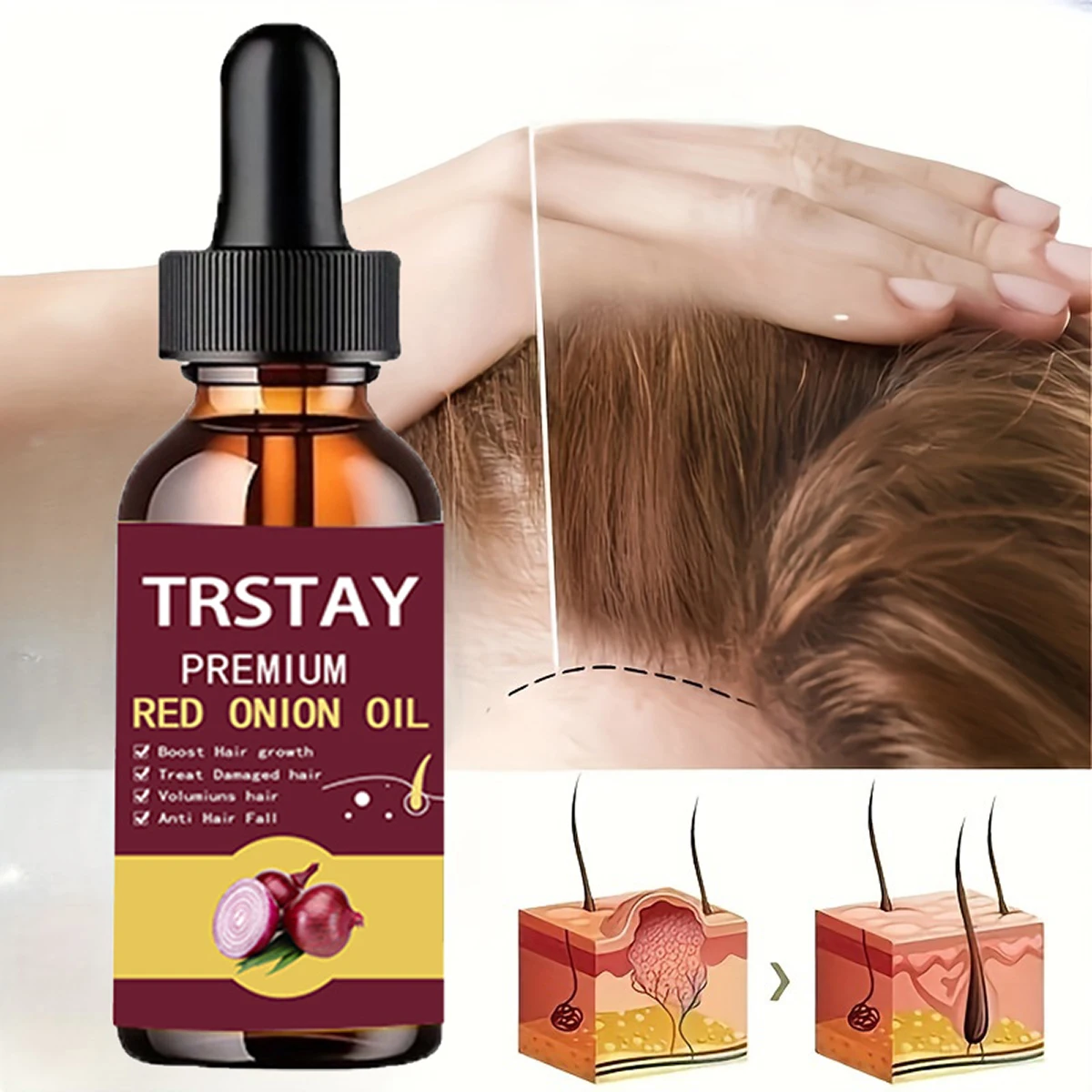 Hair Grouth Fast Onion Black Seed Essential Oils Oil Spray for Hair Care and Growth To Prevent Hair Loss