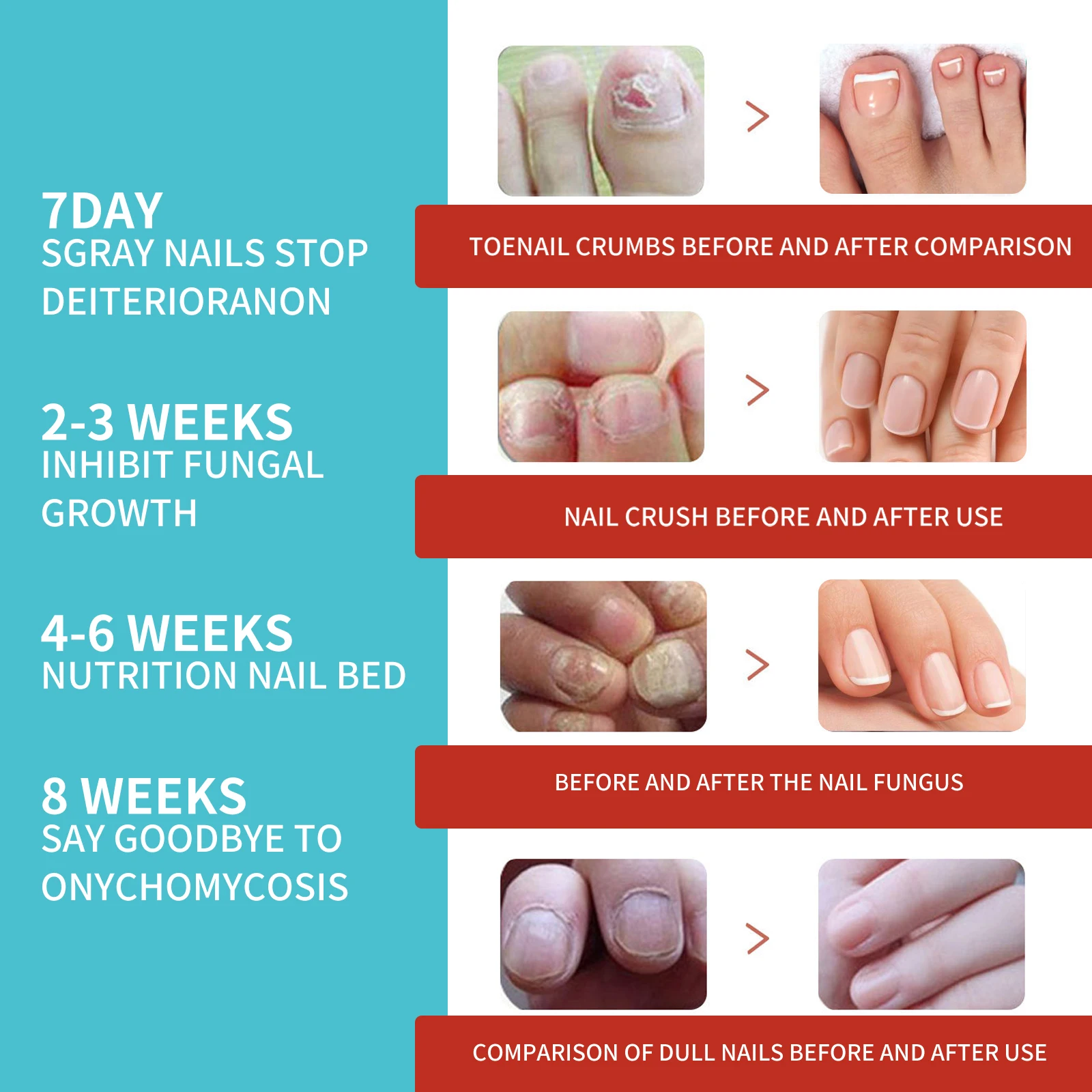 16PCS Toenail Fungus Treatment Stickers Ingrowning Toenail Corrector Paronychia Repair Patch Fungus Removal Nail Care Products