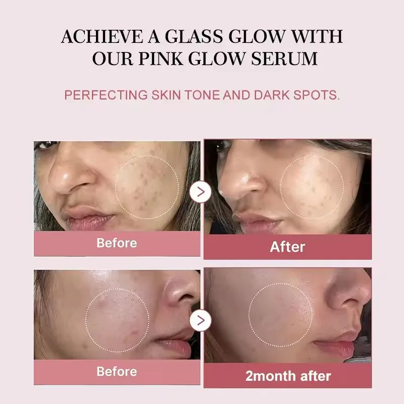 Dull Skin Boosts Skin Elasticity Stimulates Skin Renewal Repair