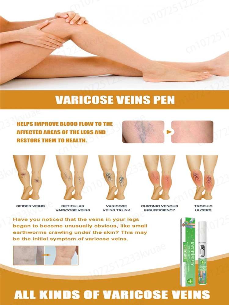 静脈を効果的に閉鎖するレーザー治療の新しいオプション