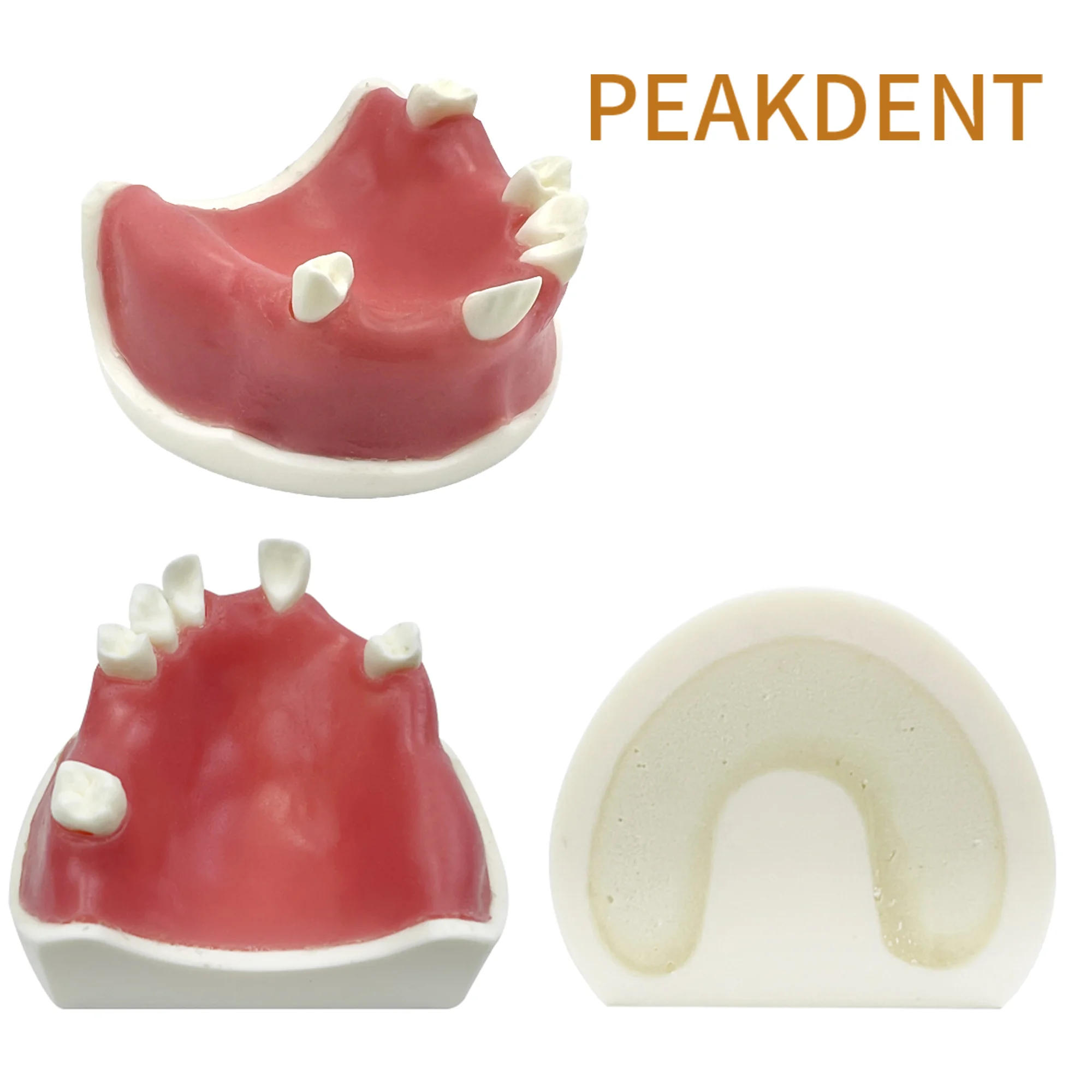 

Dental Implant Model Teeth Restoration Teaching Study Model Typodont With Soft Gums Dentistry Practice Demonstration Model