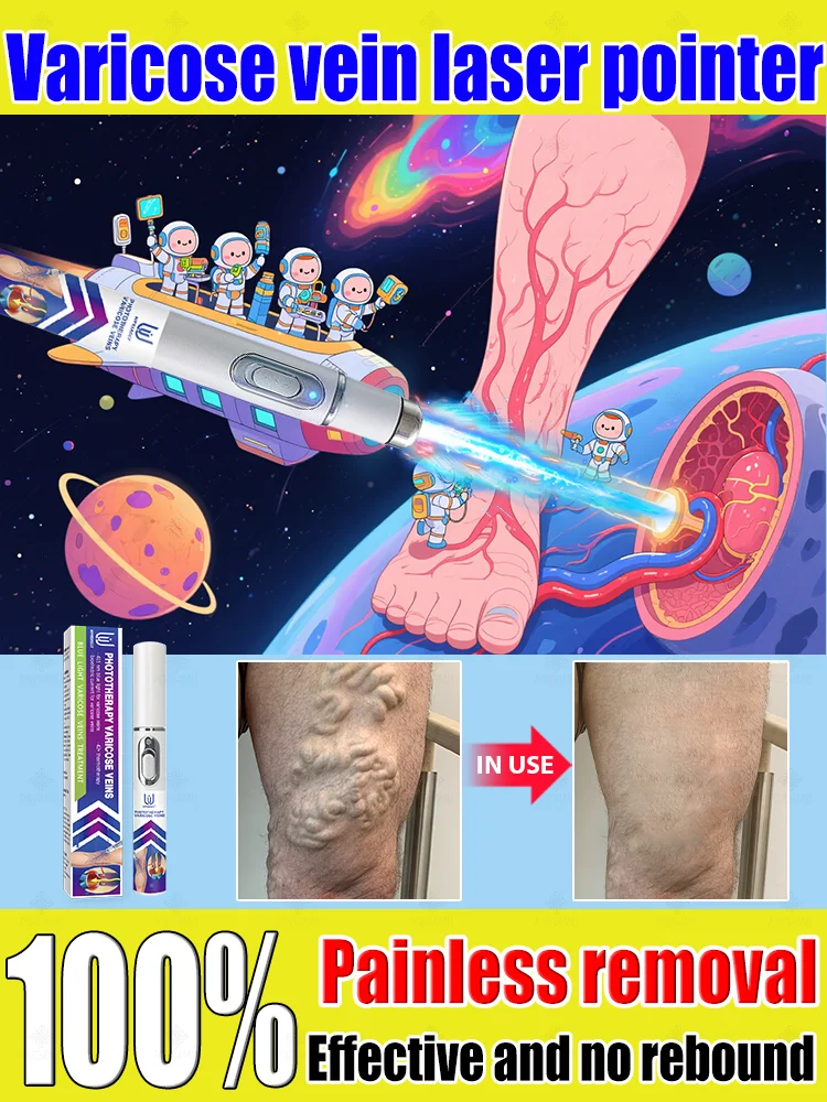 

Reverse leg health in 7 days and say goodbye to varicose vein recurrence