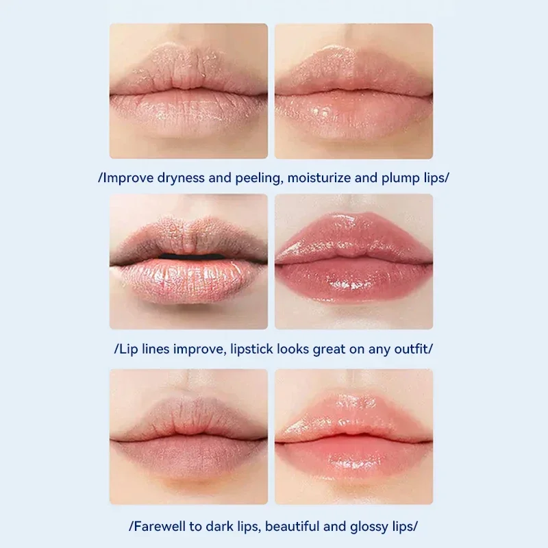 Lip Balm Remove Dark Pigment Whitening Moisturizing Cream  Hyaluronic Acid Exfoliating Dead Skin Lightening Beauty Health Care