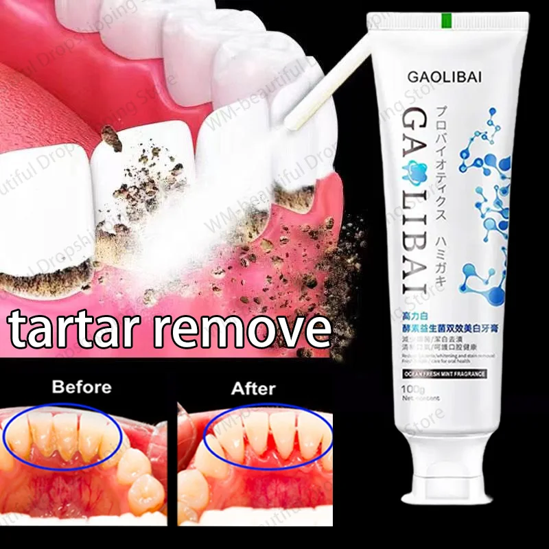 Remove Yellow Teeth Toothpaste Dental Calculus Removal Mouth Odour Bad Breath Preventing Periodontitis Fluoride Toothpaste