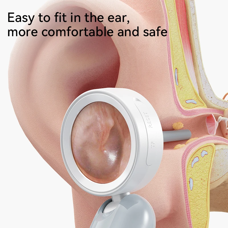 Thumbnail 4 - #34 Latest Ear Care Offers