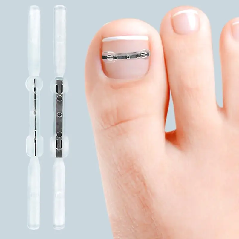 Corrector de uñas encarnadas, herramientas para pedicura, recuperación integrada, tratamiento de uñas de los pies, soporte profesional para alisar uñas encarnadas