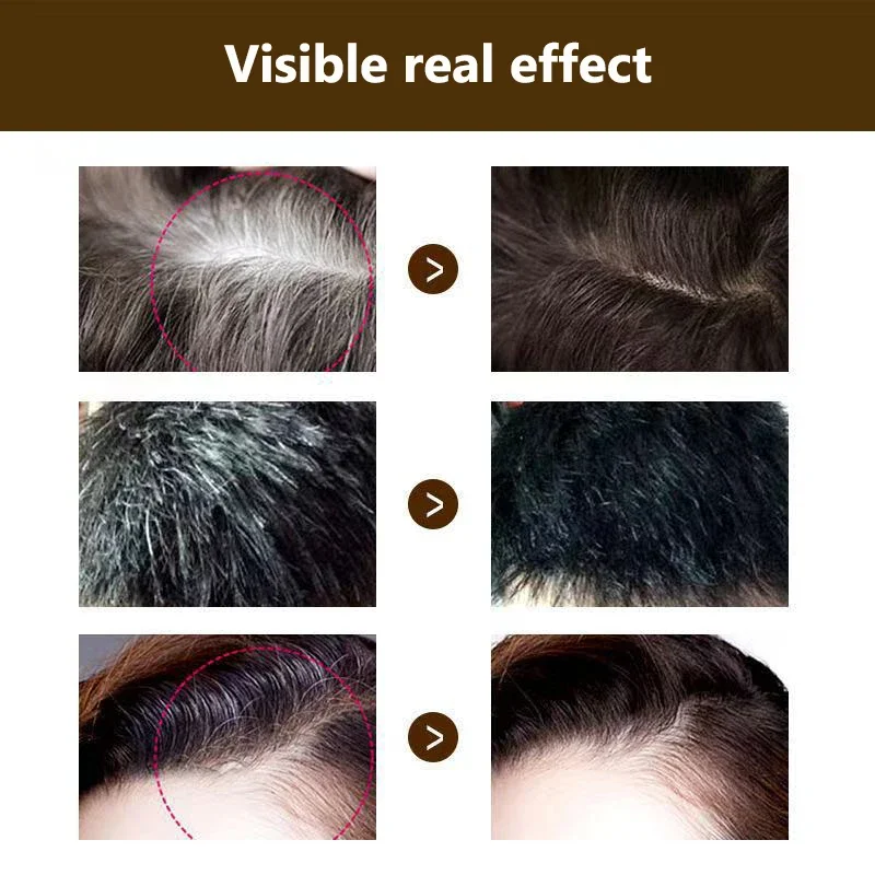 5PCS Temporary Hair Dye Pen One Time Gray Hair Root Concealer  Hairline Shadow Touch Up Cream Portable Hair Styling Makeup Accessory for Men Women Daily Use